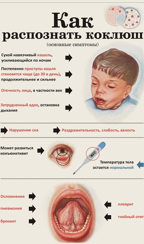 koklyush simptomy i lechenie u vzroslogo zaraznost inkubacionnyj period5